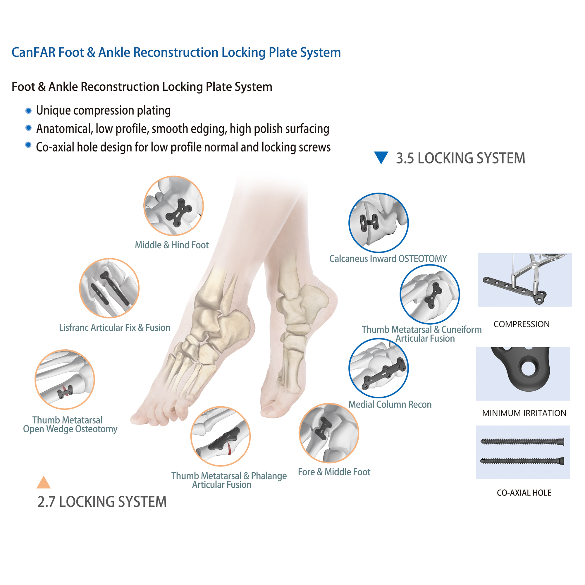 Orthopedic Implants for Foot and Ankle System Hind Foot Reconstruction Trauma Implants Locking Plate