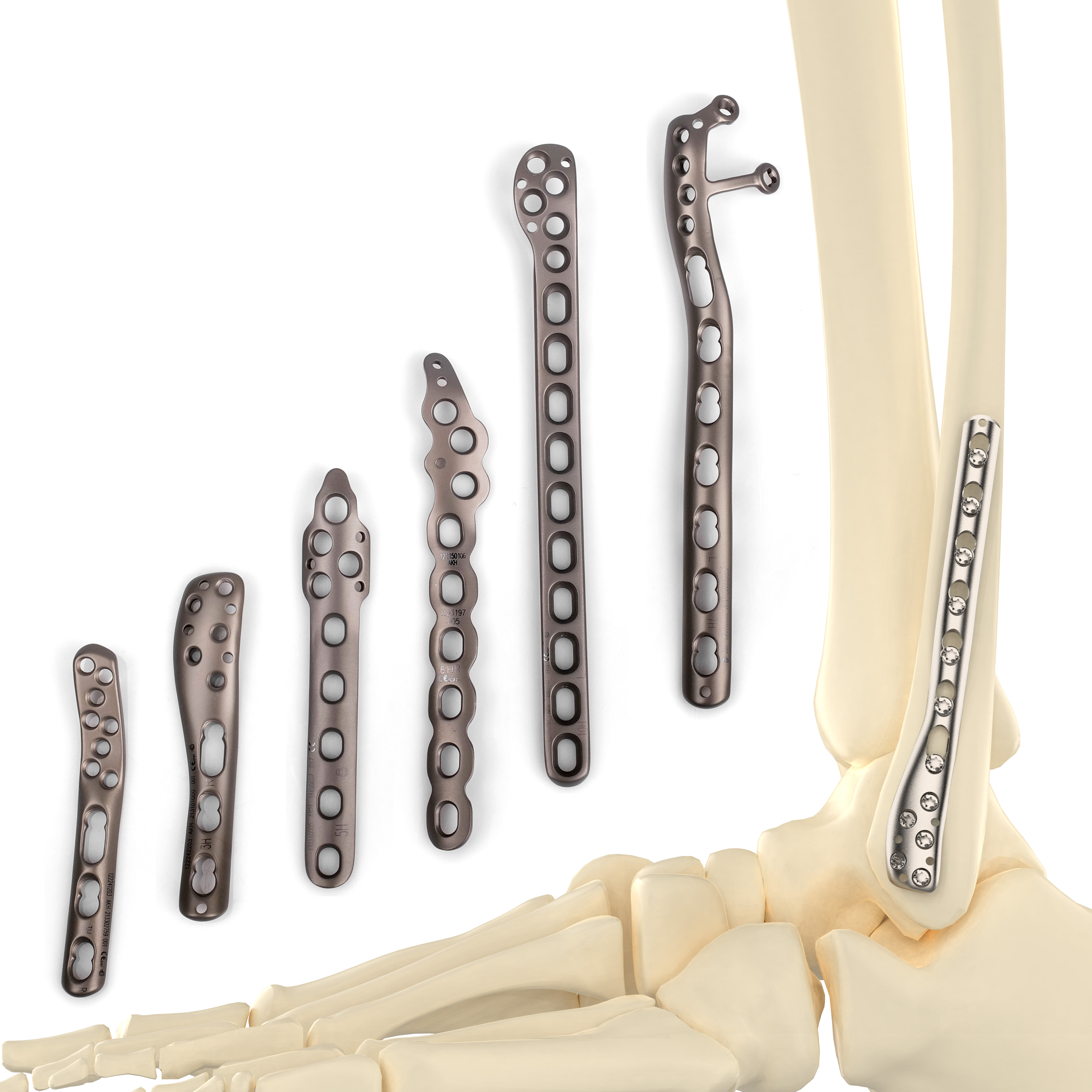 CANWELL Fibula Plate Titanium Posterolateral Distal Fibula Locking Plate 2.7/3.5mm Screw System Orthopedic Implant Manufacturer