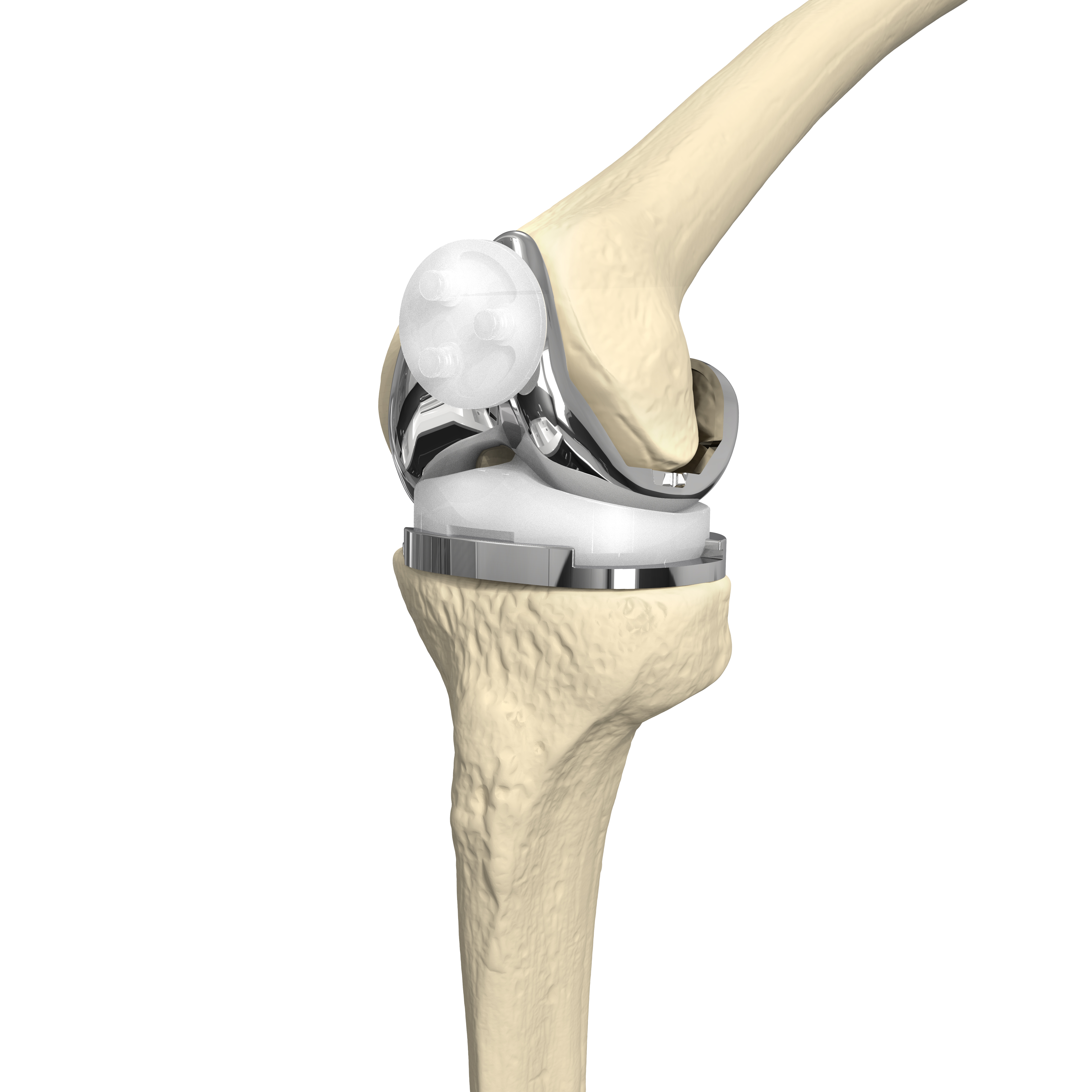 Knee Joint