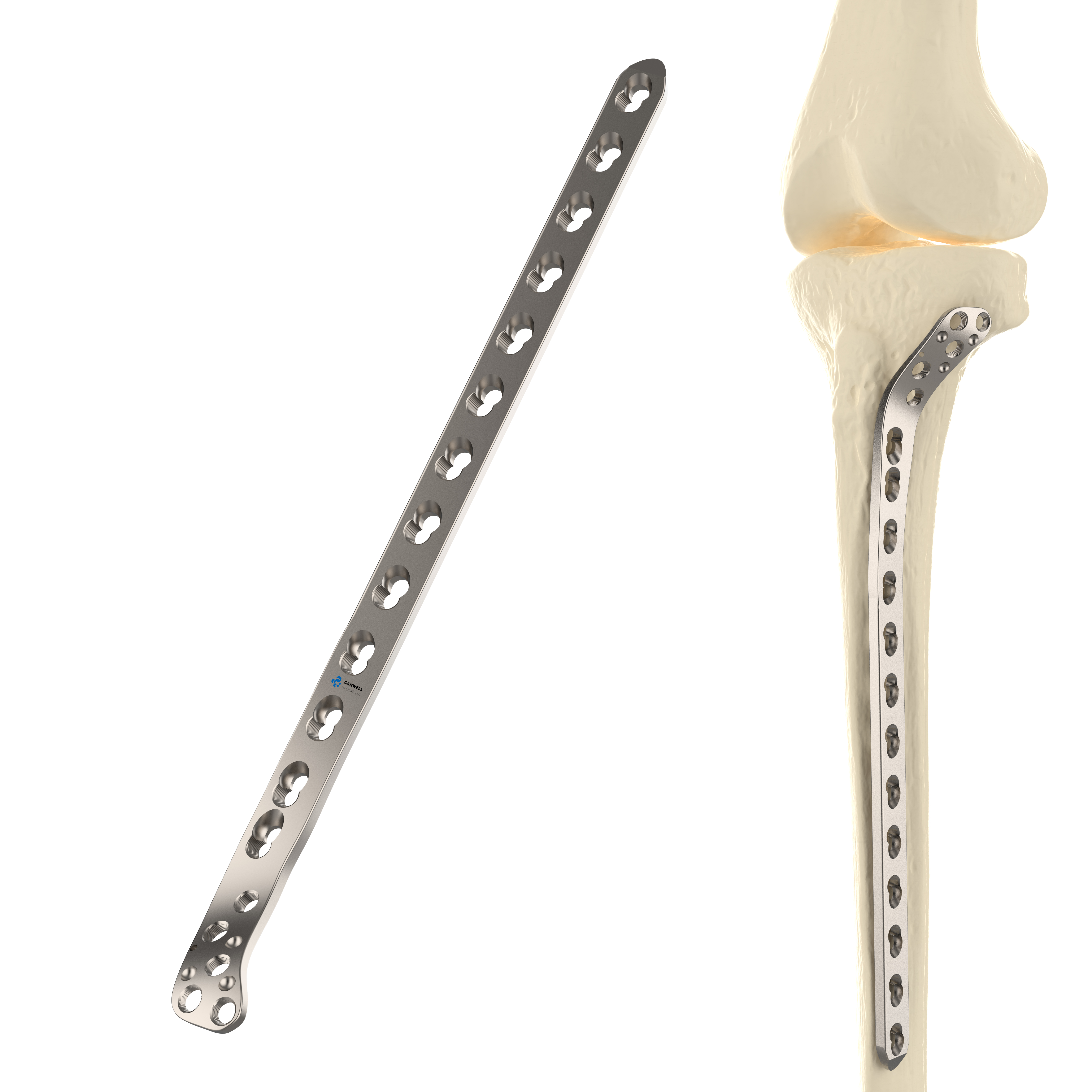 Lateral Tibial Plate