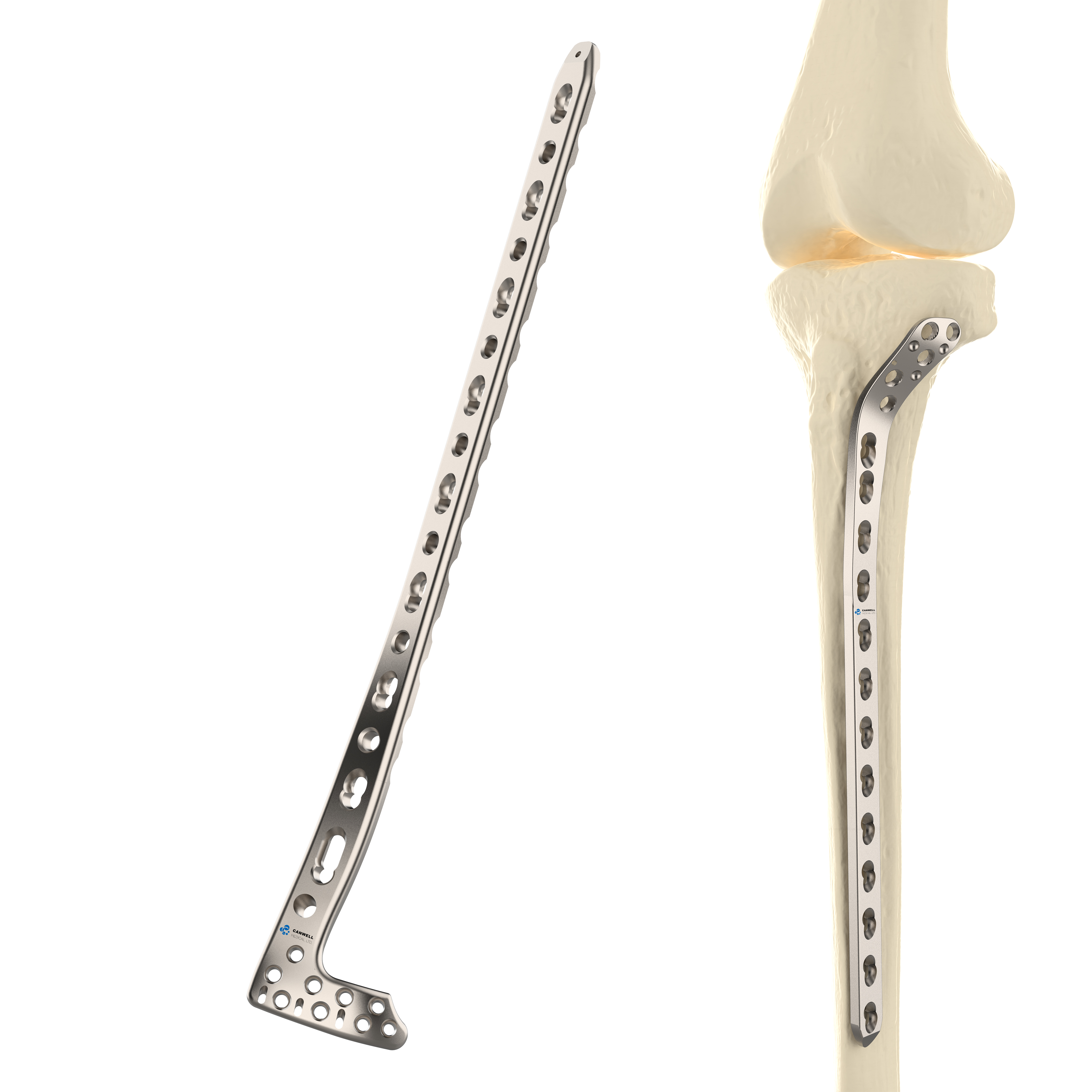 CANWELL Distal Tibial Low Profile Locking Plate Titanium Compression