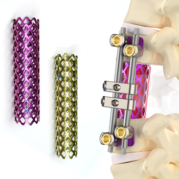 Titanium Mesh & PEEK Interbody Cages