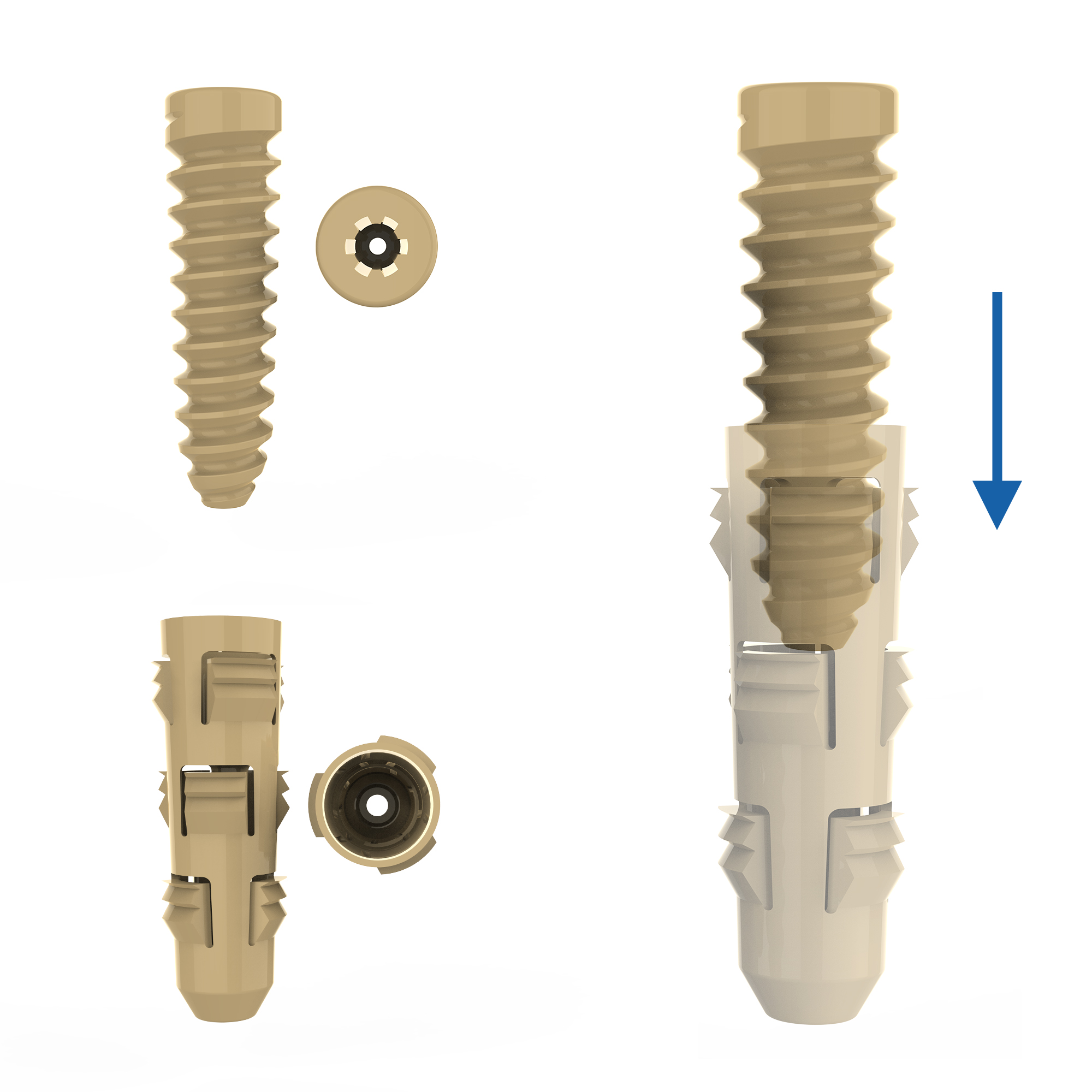 CANWELL Sports Medicine Bioabsorbable PEEK Screw