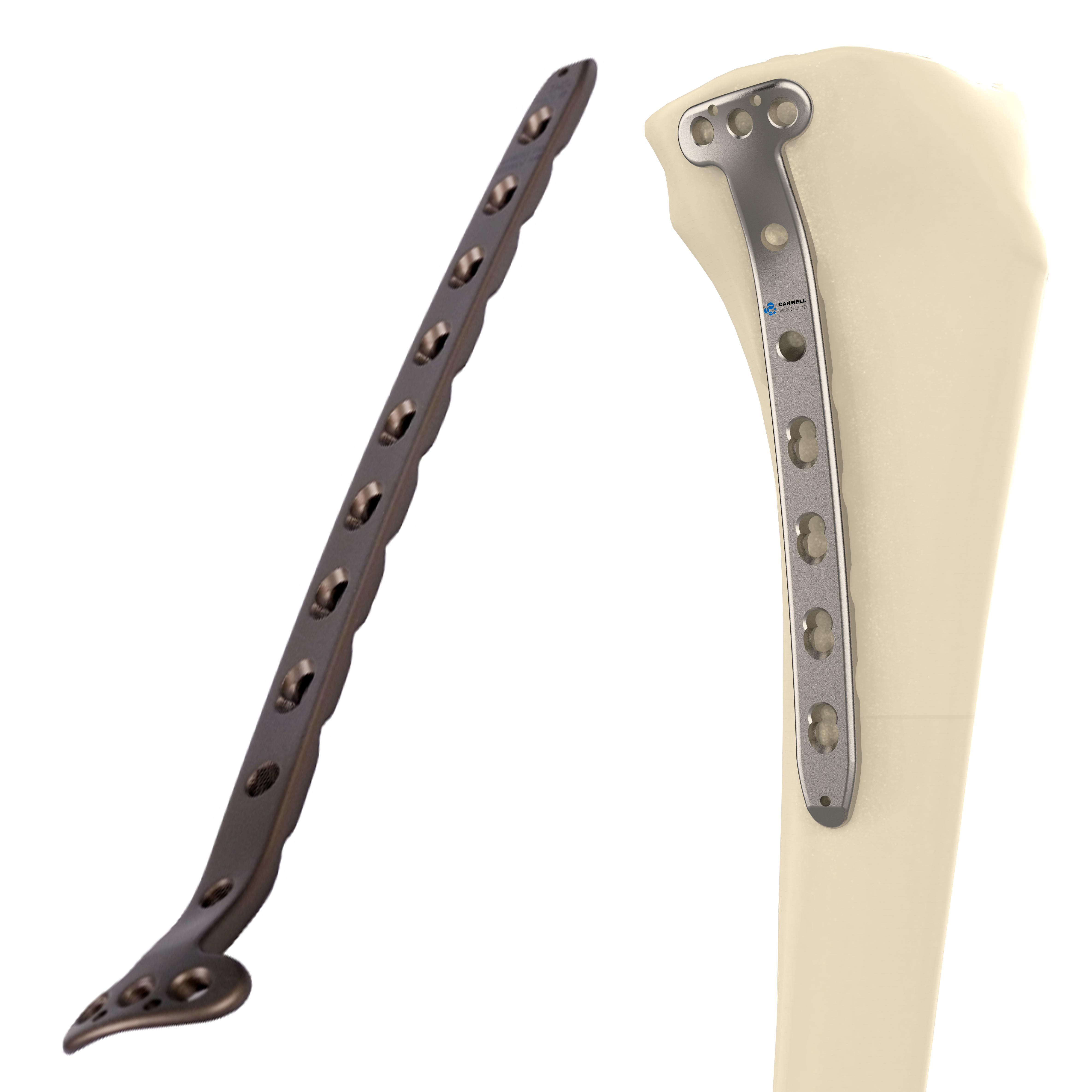 Proximal Medial Titanium Tibial Locking Plate Knee Trauma