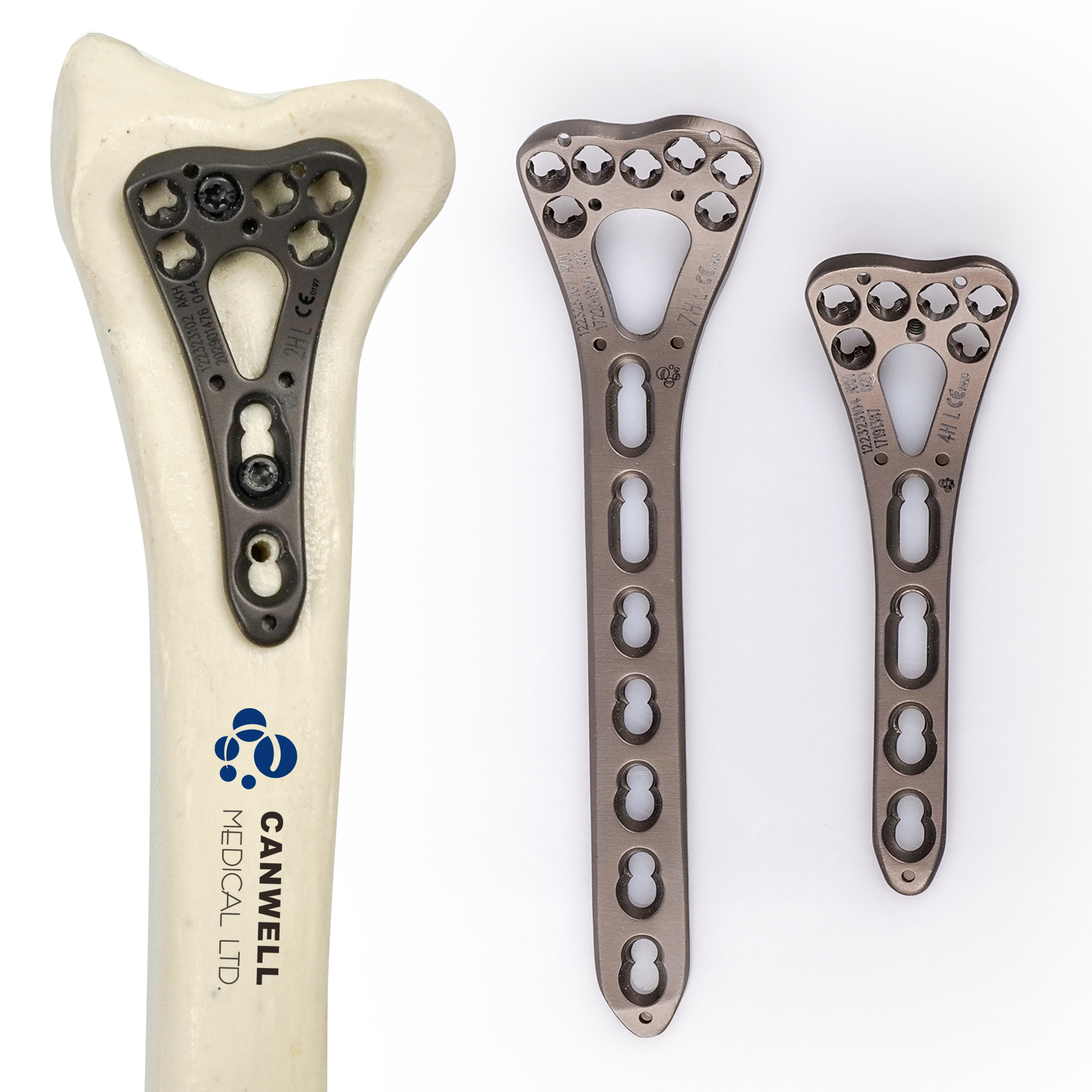 CANWELL 2.4 2.7mm VA Titanium Distal Palmar Radius Locking Plate Volar Wrist Price Bone Fracture Orthopedic Implants CE ISO