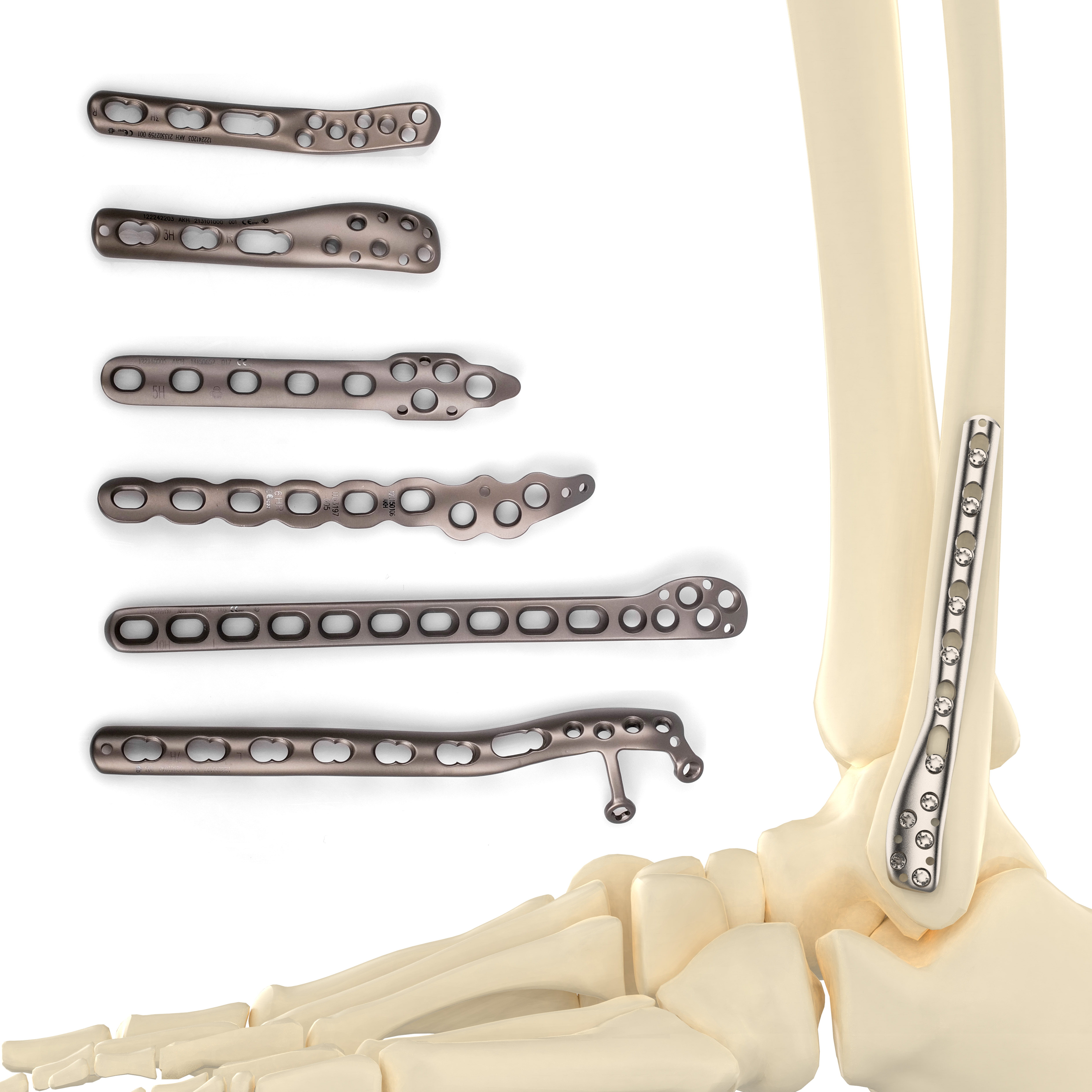 CANWELL Fibula Plate Titanium Posterolateral Distal Fibula Locking Plate 2.7/3.5mm Screw System Orthopedic Implant Manufacturer
